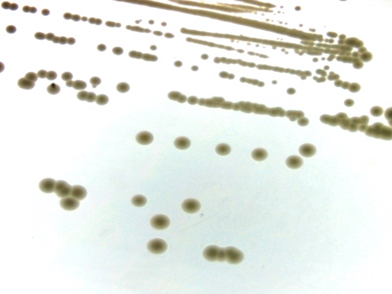 Staphylococcus aureus Enfeksiyonlarının Tedavisi ve Cilt Homeostazının Sağlanmasında Antimikrobiyal Taşıyıcı Hedefe Yönelik Uyaranlara Duyarlı Nano-yapılar M-Era-Net (2022-Devam ediyor)